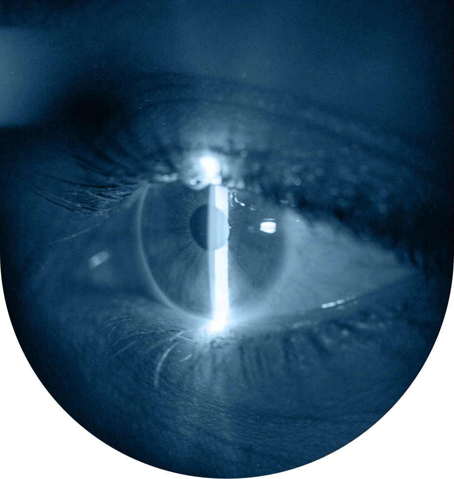 Eye-Image