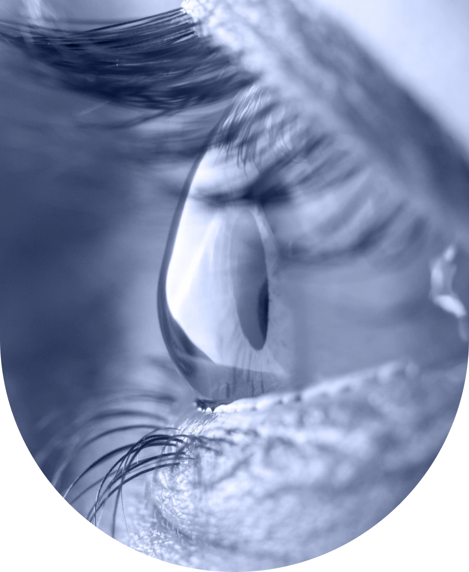 contaract-eye-image