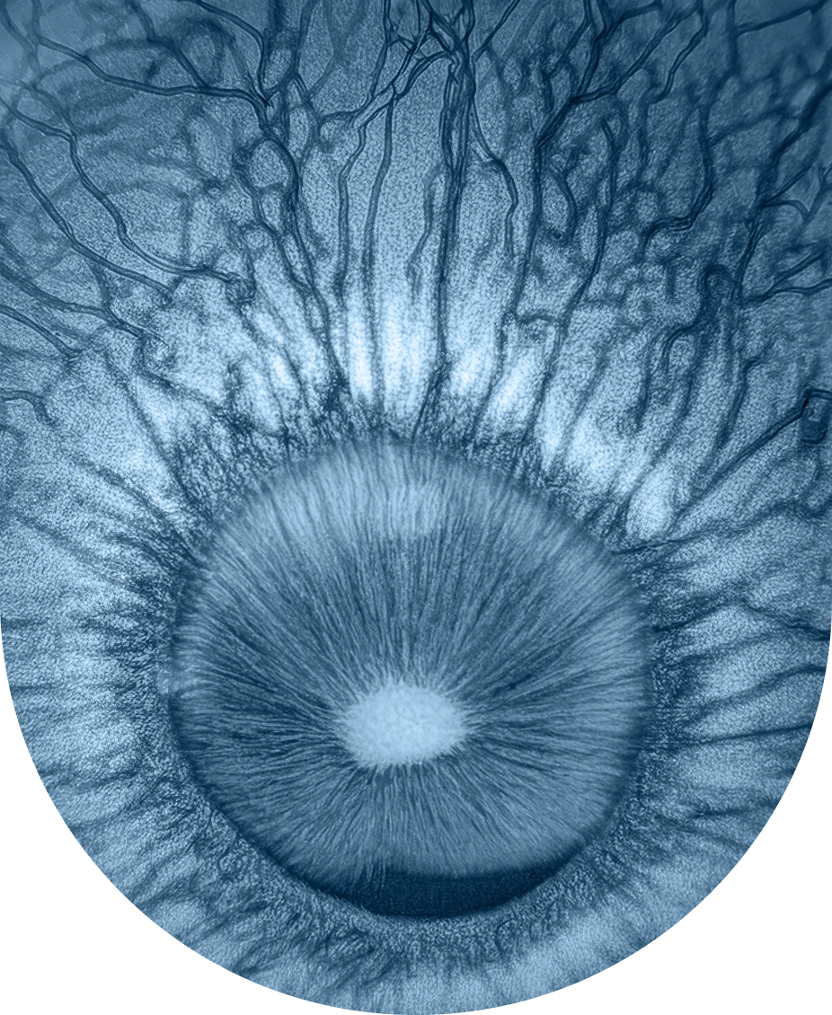 retina-eye-image