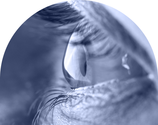 cataract_mobile
